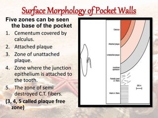 Surface Morphology of Pocket Walls
Five zones can be seen
the base of the pocket
1. Cementum covered by
calculus.
2. Attached plaque
3. Zone of unattached
plaque.
4. Zone where the junction
epithelium is attached to
the tooth.
5. The zone of semi
destroyed C.T. fibers.
(3, 4, 5 called plaque free
zone)
 