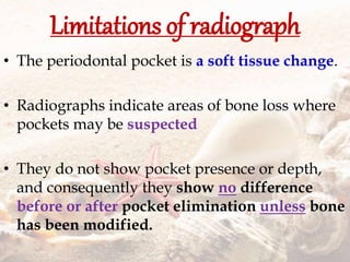 Limitations of radiograph
• The periodontal pocket is a soft tissue change.
• Radiographs indicate areas of bone loss where
pockets may be suspected
• They do not show pocket presence or depth,
and consequently they show no difference
before or after pocket elimination unless bone
has been modified.
 