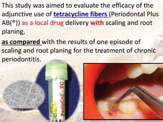 This study was aimed to evaluate the efficacy of the
adjunctive use of tetracycline fibers (Periodontal Plus
AB(®)) as a local drug delivery with scaling and root
planing,
as compared with the results of one episode of
scaling and root planing for the treatment of chronic
periodontitis.
 