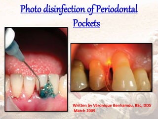 Photo disinfection of Periodontal
Pockets
Written by Véronique Benhamou, BSc, DDS
March 2009
 