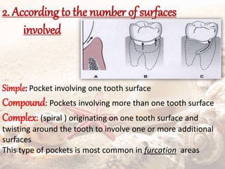 2. According to the number of surfaces
involved
Simple: Pocket involving one tooth surface
Compound: Pockets involving more than one tooth surface
Complex: (spiral ) originating on one tooth surface and
twisting around the tooth to involve one or more additional
surfaces
This type of pockets is most common in furcation areas
 