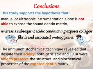 Conclusions
This study supports the hypothesis that:
manual or ultrasonic instrumentation alone is not
able to expose the sound dentin matrix,
whereas a subsequent acidic conditioning exposes collagen
fibrils and associated proteoglycans.
The immunohistochemical technique revealed that
despite their acidity, both citric acid and EDTA were
able to preserve the structural and biochemical
properties of the exposed dentin matrix
 