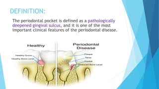DEFINITION:
The periodontal pocket is defined as a pathologically
deepened gingival sulcus, and it is one of the most
important clinical features of the periodontal disease.
 