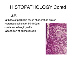 HISTOPATHOLOGY Contd
J.E.
-at base of pocket is much shorter than sulcus
-coronoapical length 50-100µm
-variation in length,width
&condition of epithelial cells
 