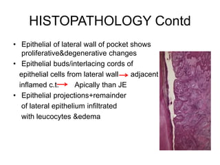 HISTOPATHOLOGY Contd
• Epithelial of lateral wall of pocket shows
proliferative&degenerative changes
• Epithelial buds/interlacing cords of
epithelial cells from lateral wall adjacent
inflamed c.t. Apically than JE
• Epithelial projections+remainder
of lateral epithelium infiltrated
with leucocytes &edema
 