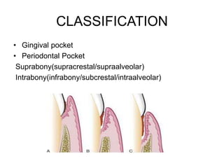 CLASSIFICATION
• Gingival pocket
• Periodontal Pocket
Suprabony(supracrestal/supraalveolar)
Intrabony(infrabony/subcrestal/intraalveolar)
 