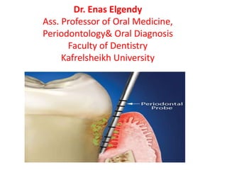 Dr. Enas Elgendy
Ass. Professor of Oral Medicine,
Periodontology& Oral Diagnosis
Faculty of Dentistry
Kafrelsheikh University
 