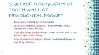 SURFACE TOPOGRAPHY OF
TOOTH WALL OF
PERIODONTAL POCKET
15
▪ Zones from the tooth surface outwards:
▪ Cementum covered by calculus – Demonstrates various
pathological surface changes
▪ Zone of attached plaque – Plaque covers calculus and extends
apically upto 100 to 500um
▪ Zone of unattached plaque – Zone of unattached plaque is
covered by this zone
 