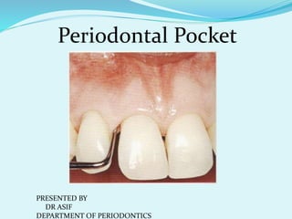 Periodontal Pocket
PRESENTED BY
DR ASIF
DEPARTMENT OF PERIODONTICS
 