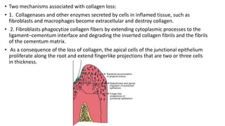 • Two mechanisms associated with collagen loss:
• 1. Collagenases and other enzymes secreted by cells in inflamed tissue, such as
fibroblasts and macrophages become extracellular and destroy collagen.
• 2. Fibroblasts phagocytize collagen fibers by extending cytoplasmic processes to the
ligament–cementum interface and degrading the inserted collagen fibrils and the fibrils
of the cementum matrix.
• As a consequence of the loss of collagen, the apical cells of the junctional epithelium
proliferate along the root and extend fingerlike projections that are two or three cells
in thickness.
 
