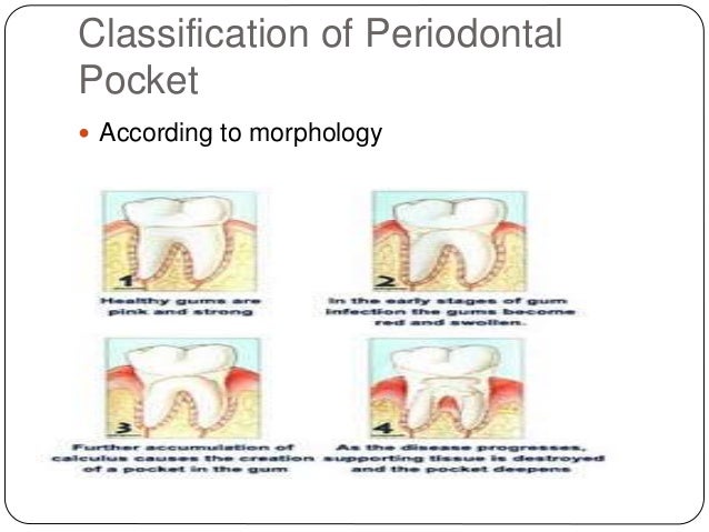 Periodontal pocket activity