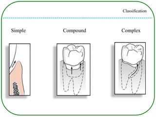 Periodontal pockets | PPTX