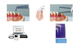 • Disc Probe
• Stent Probe
 