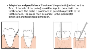 • Adaptation and parallelism:- The side of the probe tip(defined as 1 to
2mm of the side of the probe) should be kept in contact with the
tooth surface .The probe is positioned as parallel as possible to the
tooth surface. The probe must be parallel in the mesiodistal
dimension and faciolingual dimension.
 