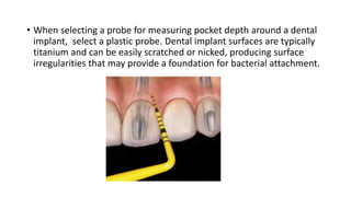 • When selecting a probe for measuring pocket depth around a dental
implant, select a plastic probe. Dental implant surfaces are typically
titanium and can be easily scratched or nicked, producing surface
irregularities that may provide a foundation for bacterial attachment.
 