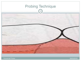 To Probe Periodontal probes | PPT