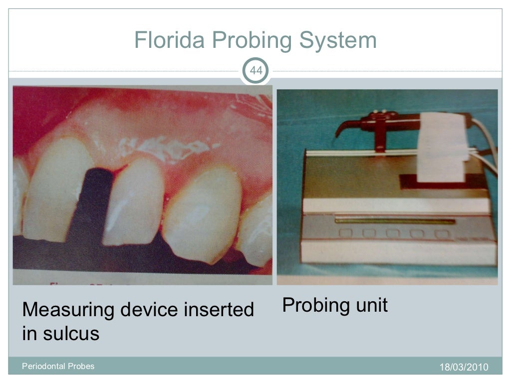 Periodontal probes