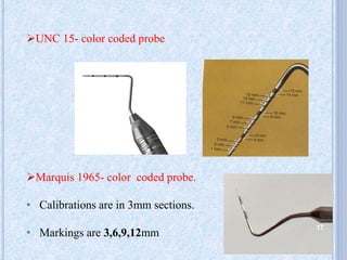 UNC 15- color coded probe
Marquis 1965- color coded probe.
• Calibrations are in 3mm sections.
• Markings are 3,6,9,12mm
17
 