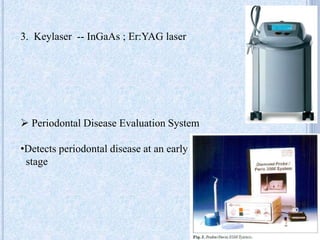 3. Keylaser -- InGaAs ; Er:YAG laser
 Periodontal Disease Evaluation System
•Detects periodontal disease at an early
stage
40
 