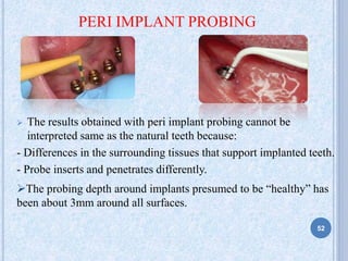 PERI IMPLANT PROBING
 The results obtained with peri implant probing cannot be
interpreted same as the natural teeth because:
- Differences in the surrounding tissues that support implanted teeth.
- Probe inserts and penetrates differently.
The probing depth around implants presumed to be “healthy” has
been about 3mm around all surfaces.
52
 