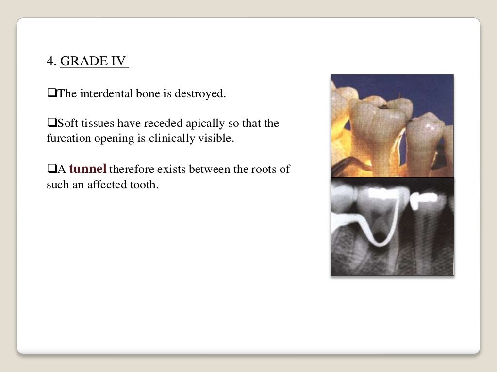 Periodontal probing