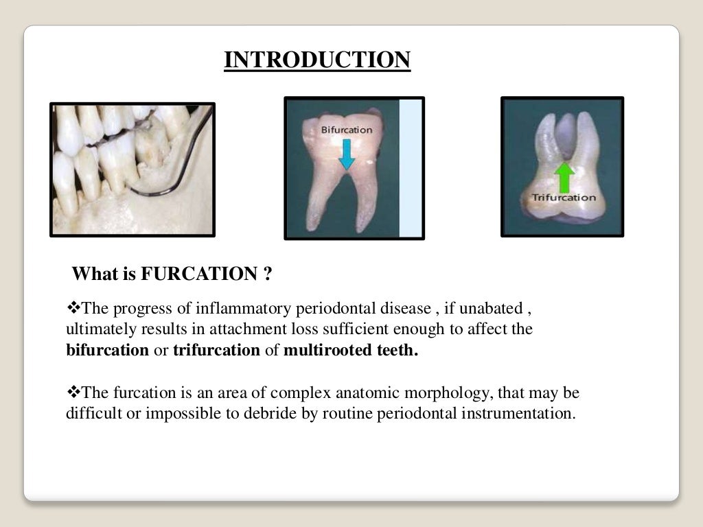 Periodontal probing