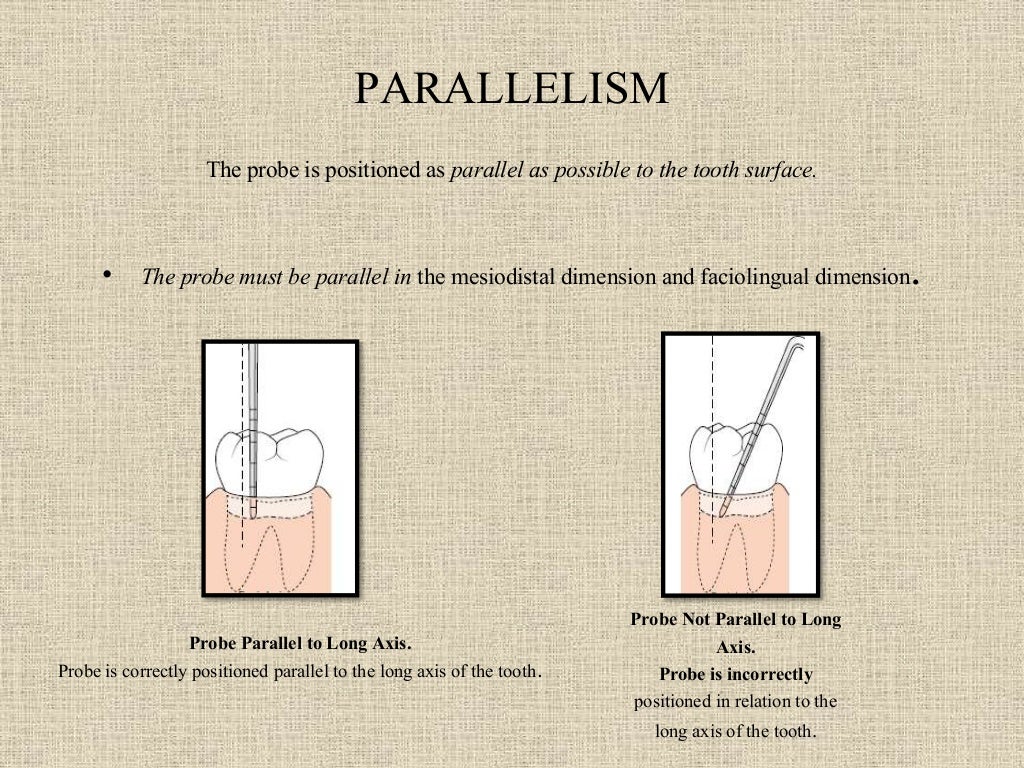 Periodontal probing and techniques