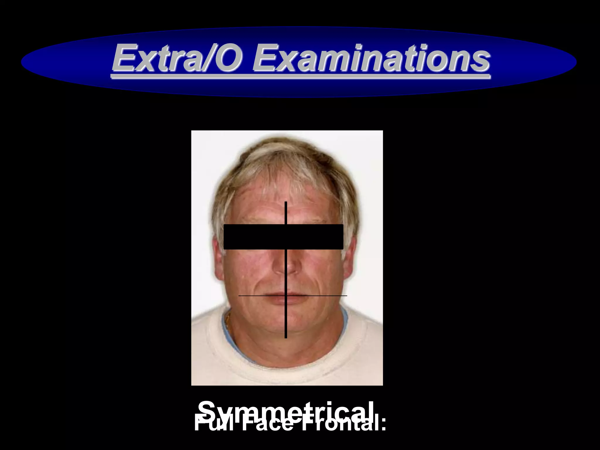 Periodontal prognosis and prosthetic treatment planing PPT