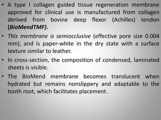 Periodontal regeneration | PPTX