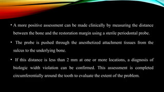 Restorative Distance Chart periodontal restorative inter relationship.pptx