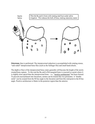 Ostectomy then is performed. The interproximal reduction is accomplished with rotating stones,
“safe-sided” interproximal bone files (such as the Schluger file) and small hand chisels.
The depth or floor of the interproximal bony crater generally will become the height of the newly
created bony septum. To this end the Bu and Li/Pal marginal bone is resected to a point where it
is slightly more apical than the interproximal bone – i.e., “positive architecture” has been formed.
To prevent encroachment into furcations, molars can be treated like two premolars. A “double
smile” can be created from the M line angle to the furcation and from this mid-point to the D line
angle. Positive architecture is flatter in the posterior region than the anterior.

15

 