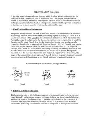 VIII. FURCATION INVASION
A furcation invasion is a pathological situation, which develops when bone loss exposes the
division (furcation) between the roots of multirooted teeth. The gingival margin usually is
coronal to the furcation. The narrow opening of the furcation results in restricted access which
makes plaque control efforts difficult, if not impossible. Treatment of this problem is undertaken
to facilitate oral hygiene, generally by altering the anatomy of the area.
A. Classification of Furcation Invasions
The greater the exposure of a furcation by bone loss, the less likely treatment will be successful.
Accordingly, furcation invasions have been classified by degrees of severity as Class I, II, or III
(Easley and Drennan 1969). Class I describes the anatomic situation in which the interradicular
fluting (the concavity just coronal to the division between the roots) is exposed but in which the
furcation itself is intact. Class II describes the situation in which the bone loss has partially
exposed the furcation but is not completely through to the other side. In a Class III, bone loss has
resulted in complete exposure of the furcation from one side to another, i.e., - a “through &
through” defect. In a Class III furcation in a maxillary molar only one root may be involved. For
example the invasion could enter from the facial and exit the mesial-palatal. An important
modification of this basic classification has been made with respect to Class II invasions. The
extent of the horizontal invasion is recorded. A Class II furcation invasion with a 2mm horizontal
component is not as difficult to treat as is a Class II with 6mm of horizontal breakdown.
X-Sections of Lower Molar at Level Just Apical to Furca

Class I

Class II

Class III

B. Detection of Furcation Invasions
The furcation invasion is detected by passing a curved instrument (pigtail explorer, worn-out
curet, Nabers 2N probe) into the sulcus or pocket on the facial and lingua/palatal of all molars
and from the mesial or distal of maxillary 1st premolars of the furcation. The objective is to
determine if the separation between roots can be felt and, if so, to what degree. A curved
instrument is particularly valuable in the detection of distopalatal or mesiopalatal furcations.

24

 