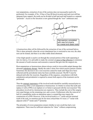 root amputations, extraction of one of the sections does not necessarily need to be
performed. For example, if No. 19 has a Class III furcal invasion and each root still has
adequate bone support, the tooth can be divided in half and each half treated as a separate
“premolar”. Access to the furcation is now gained though the “new” embrasure area.

A hemisection often will be followed by the extraction of one of the sectioned halves.
This is done primarily when the severe attachment loss is restricted to one root, the other
root can be treated, and there is no other stable distal abutment.
A bur (high-speed) is used to cut through the coronal portion of the tooth separating it
into two halves. It is advisable to make the coronal cut prior to flap reflection to minimize
the amount of tooth structure and restorative material that gets into the surgical site.
Root amputations or hemisections almost always result in irreversible pulpal damage that
demands endodontic therapy. Ideally the endo is done first which ensures patient comfort.
Sometimes the decision to do a root resection cannot be made until flaps have been
reflected and the periodontal status has been carefully assessed. The RCT must be
delayed until after the resection. Regardless of the sequence, consultation with both
endodontist and periodontist is required to ensure both aspects of the treatment can be
performed.
Thus the strategic importance of the involved tooth should be carefully assessed prior to
commencing either a root amputation or hemisection. Is it better to extract the tooth and
replace it with a FPD or an implant or is it better to proceed with the root resection? The
procedures involved in a hemisection are expensive. They include the cost of the surgery,
root canal therapy on the remaining root, and a crown. Furthermore after the removal of
half of a mandibular molar an edentulous space is created that may require the
construction of a FPD. However, if the involved tooth is a 1st molar and the terminal
tooth in the arch, its retention may be far more critical than if it were a 1st molar with
adjacent solid 2nd molar and 2nd premolar.
The principles of crown preparation remain whether or not a tooth has had a root
amputation. There must be sufficient reduction for “draw” without compromising

29

 