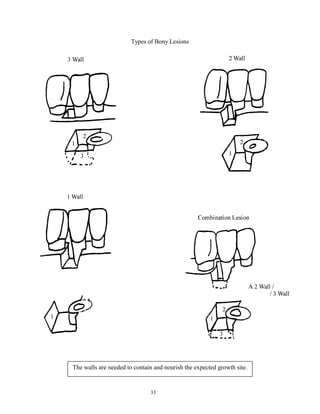 Types of Bony Lesions

The walls are needed to contain and nourish the expected growth site.

33

 