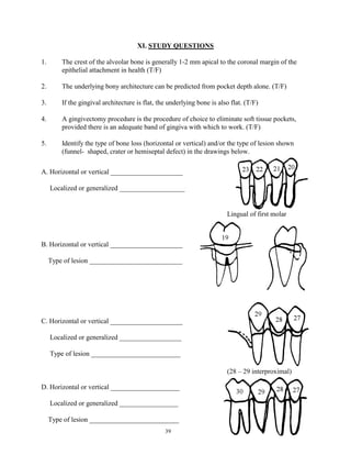 XI. STUDY QUESTIONS
1.

The crest of the alveolar bone is generally 1-2 mm apical to the coronal margin of the
epithelial attachment in health (T/F)

2.

The underlying bony architecture can be predicted from pocket depth alone. (T/F)

3.

If the gingival architecture is flat, the underlying bone is also flat. (T/F)

4.

A gingivectomy procedure is the procedure of choice to eliminate soft tissue pockets,
provided there is an adequate band of gingiva with which to work. (T/F)

5.

Identify the type of bone loss (horizontal or vertical) and/or the type of lesion shown
(funnel- shaped, crater or hemiseptal defect) in the drawings below.

A. Horizontal or vertical _____________________
Localized or generalized ___________________

Lingual of first molar

B. Horizontal or vertical _____________________
Type of lesion ___________________________

C. Horizontal or vertical _____________________
Localized or generalized __________________
Type of lesion __________________________
(28 – 29 interproximal)
D. Horizontal or vertical ____________________
Localized or generalized _________________
Type of lesion __________________________
39

 