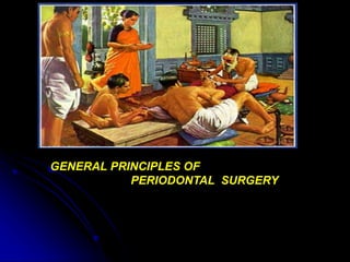 GENERAL PRINCIPLES OF
PERIODONTAL SURGERY
 