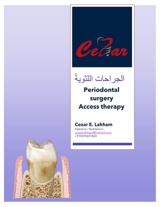 Facebook Page: Dr Cezar ‫سزار‬ .‫د‬
‫اللثوية‬ ‫الجراحات‬
Periodontal
surgery
Access therapy
Cezar E. Lahham
Palestine / Bethlehem
ceazarlahham@hotmail.com
+970595031843
 