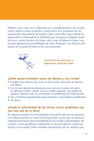 | 11
Debido a que cada caso es diferente, no es posible predecir con certeza
cuáles injertos darán resultados a largo plazo. Los resultados de los
tratamientos dependerán de muchas cosas, entre ellas, hasta dónde ha
progresado la enfermedad, la habilidad para mantener la higiene bucal
en casa y ciertos factores de riesgo, tales como el hábito de fumar, que
pueden disminuir las posibilidades de éxito. Pregunte a su dentista cuál
puede ser el grado de éxito en su caso particular.
Inserción de una malla para la
regeneración guiada del tejido
¿Cómo puedo mantener sanos los dientes y las encías?
•	 Cepíllese	los	dientes	dos	veces	al	día	(usando	una	pasta	de	dientes	
con flúor).
•	 Use	la	seda	dental	regularmente	para	remover	la	placa	de	entre	
los dientes. O bien, puede usar un cepillo especial o un palillo de
madera o plástico que le recomiende un profesional de salud dental.
•	 Vaya	al	dentista	regularmente	para	chequeos	y	una	limpieza	profesional.		
•	 No fume.
¿Puede la enfermedad de las encías causar problemas que
van más allá de la boca?
En algunos estudios, los investigadores han observado que las personas
con enfermedad de las encías (en comparación con las que no tienen la
enfermedad) tienen más probabilidad de desarrollar enfermedades del
corazón o tener problemas controlando el nivel de glucosa sanguínea
(azúcar en la sangre). Otros estudios demuestran que las mujeres que
 