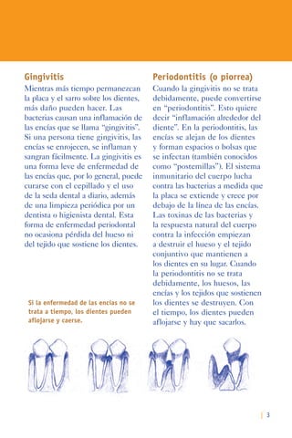 | 3
Gingivitis
Mientras más tiempo permanezcan
la placa y el sarro sobre los dientes,
más daño pueden hacer. Las
bacterias causan una inflamación de
las encías que se llama “gingivitis”.
Si una persona tiene gingivitis, las
encías se enrojecen, se inflaman y
sangran fácilmente. La gingivitis es
una forma leve de enfermedad de
las encías que, por lo general, puede
curarse con el cepillado y el uso
de la seda dental a diario, además
de una limpieza periódica por un
dentista o higienista dental. Esta
forma de enfermedad periodontal
no ocasiona pérdida del hueso ni
del tejido que sostiene los dientes.
Periodontitis (o piorrea)
Cuando la gingivitis no se trata
debidamente, puede convertirse
en “periodontitis”. Esto quiere
decir “inflamación alrededor del
diente”. En la periodontitis, las
encías se alejan de los dientes
y forman espacios o bolsas que
se infectan (también conocidos
como “postemillas”). El sistema
inmunitario del cuerpo lucha
contra las bacterias a medida que
la placa se extiende y crece por
debajo de la línea de las encías.
Las toxinas de las bacterias y
la respuesta natural del cuerpo
contra la infección empiezan
a destruir el hueso y el tejido
conjuntivo que mantienen a
los dientes en su lugar. Cuando
la periodontitis no se trata
debidamente, los huesos, las
encías y los tejidos que sostienen
los dientes se destruyen. Con
el tiempo, los dientes pueden
aflojarse y hay que sacarlos.
Si la enfermedad de las encías no se
trata a tiempo, los dientes pueden
aflojarse y caerse.
 