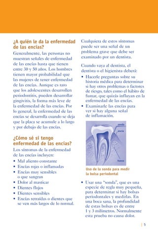 | 5
¿A quién le da la enfermedad
de las encías?
Generalmente, las personas no
muestran señales de enfermedad
de las encías hasta que tienen
entre 30 y 50 años. Los hombres
tienen mayor probabilidad que
las mujeres de tener enfermedad
de las encías. Aunque es raro
que los adolescentes desarrollen
periodontitis, pueden desarrollar
gingivitis, la forma más leve de
la enfermedad de las encías. Por
lo general, la enfermedad de las
encías se desarrolla cuando se deja
que la placa se acumule a lo largo
y por debajo de las encías.
¿Cómo sé si tengo
enfermedad de las encías?
Los síntomas de la enfermedad
de las encías incluyen:
•	 Mal	aliento	constante	
•	 Encías	rojas	o	inflamadas	
•	 Encías	muy	sensibles	
o que sangran
•	 Dolor	al	masticar	
•	 Dientes	flojos	
•	 Dientes	sensibles	
•	 Encías	retraídas	o	dientes	que	
se ven más largos de lo normal.
Cualquiera de estos síntomas
puede ser una señal de un
problema grave que debe ser
examinado por un dentista.
Cuando vaya al dentista, el
dentista o el higienista deberá:
•	 Hacerle	preguntas	sobre	su	
historia médica para determinar
si hay otros problemas o factores
de riesgo, tales como el hábito de
fumar, que quizás influyan en la
enfermedad de las encías.
•	 Examinarle	las	encías	para	
ver si hay alguna señal
de inflamación.
encía
sonda
hueso
Uso de la sonda para medir
la bolsa periodontal
•	 Usar una “sonda”, que es una
especie de regla muy pequeña,
para determinar si hay bolsas
periodontales y medirlas. En
una boca sana, la profundidad
de estas bolsas es de entre
1 y 3 milímetros. Normalmente
esta prueba no causa dolor.
 