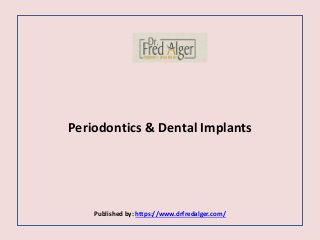 Periodontics & Dental Implants
Published by: https://www.drfredalger.com/
 