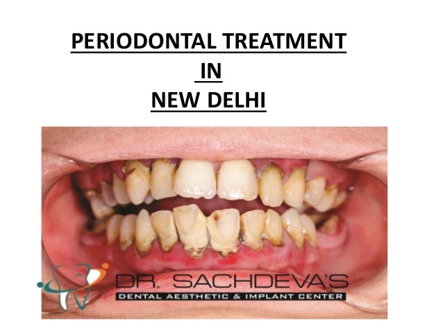 periodontic