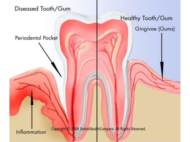 periodontic