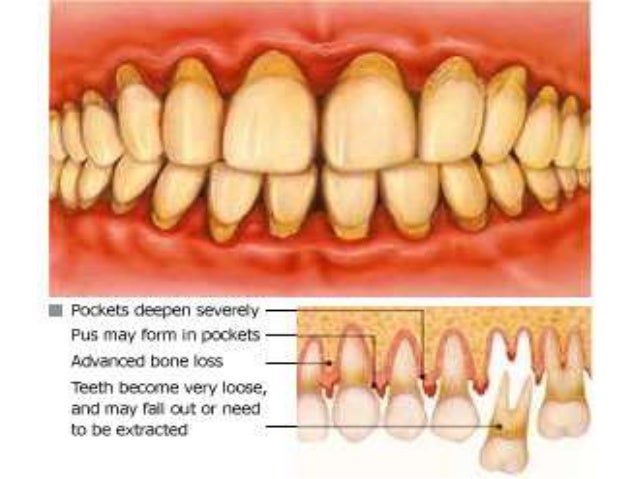 periodontic