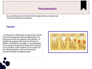 Periodontitis
Es una inflamación e infección de los ligamentos y huesos que
sirven de soporte a los dientes.
Causas
La infección e inflamación se diseminan desde
las encías (gingiva) hasta los ligamentos y el
hueso que sirven de soporte a los dientes. La
pérdida de soporte hace que los dientes se
aflojen y finalmente se caigan. La periodontitis
es la causa principal de la caída de los dientes
en los adultos. Este trastorno no es común en
los niños pequeños, pero se incrementa
durante los años de adolescencia.
 