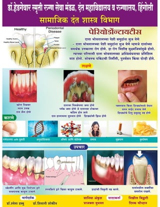 Periodontitis Poster