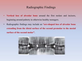 • Vertical loss of alveolar bone around the first molars and incisors,
beginning around puberty in otherwise healthy teenagers.
• Radiographic findings may include an “arc-shaped loss of alveolar bone
extending from the distal surface of the second premolar to the mesial
surface of the second molar”.
Radiographic Findings
 