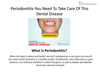 Periodontitis-You Need To Take Care Of This
Dental Disease
When the topic is about oral health, we can’t compromise as our gums are one of
the most critical elements in a healthy mouth. Periodontitis, also referred to as gum
disease, is an ordinary condition in which the gums, as well as deeper periodontal
structures, become aroused.
What Is Periodontitis?
 