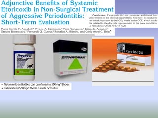 Aggressive Periodontitis