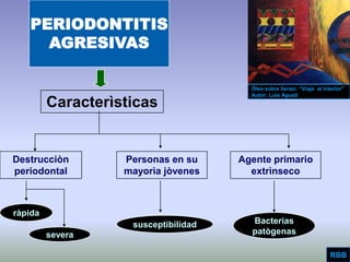 Aggressive Periodontitis